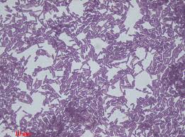 Bacillus Subtilis
