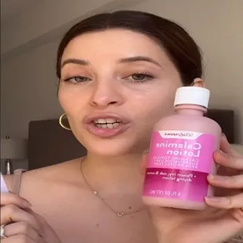 Calamin Lotion