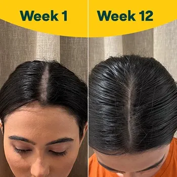 Hair Care Capsules