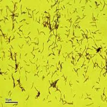 Lactobacillus Acidophilus