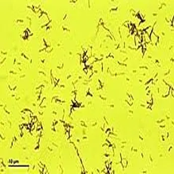 Lactobacillus Acidophilus