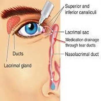ophthalmic Drops