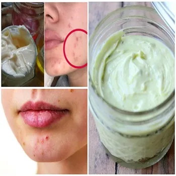 Skin Care Orintment
