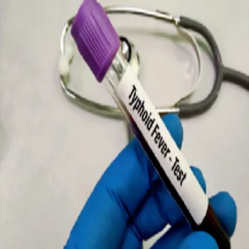 Typhoid Vaccine